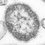 250px-Measles_virus[1]