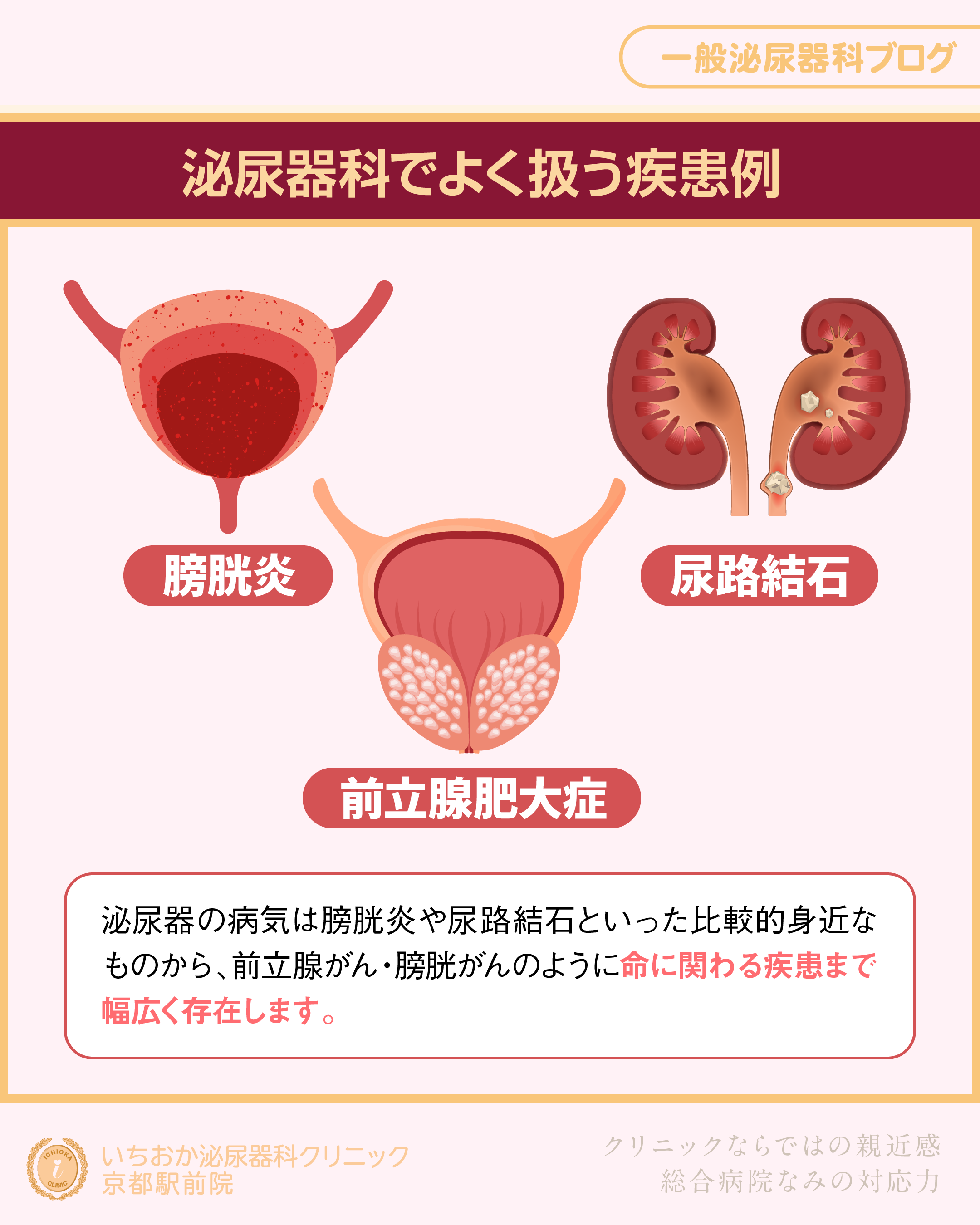 いちおか泌尿器科クリニック | 泌尿器科の病気を理解するブログ いちおか泌尿器科クリニック