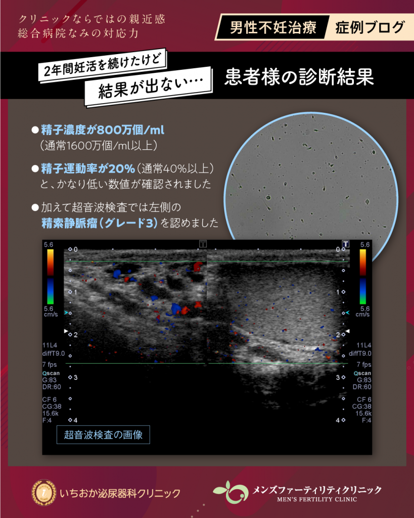 患者様の診断結果