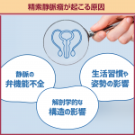 精索静脈瘤が起こる原因