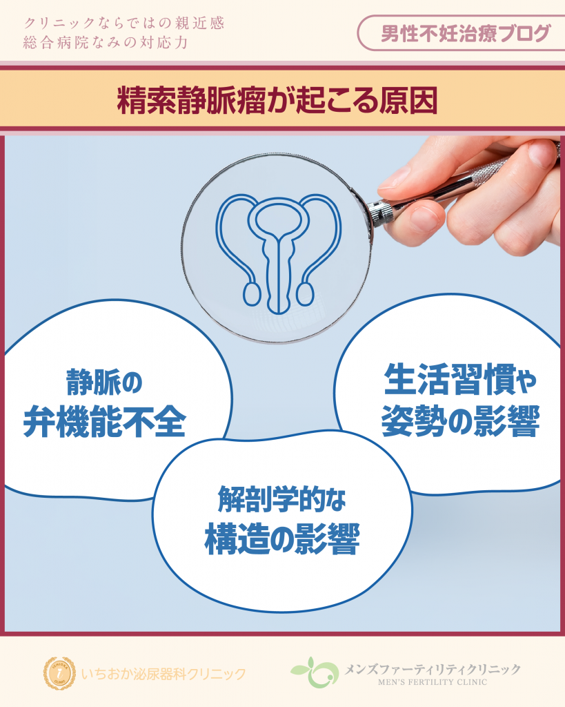 精索静脈瘤が起こる原因
