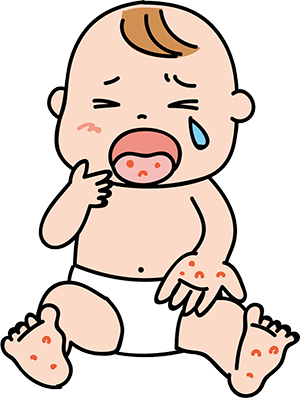 手足口病の症状